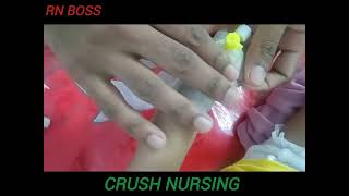 iv cannula insertion technic with 24g cannula rnboss [upl. by Lakin]