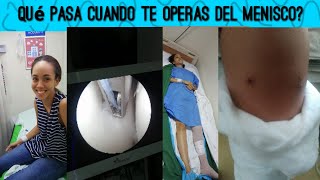 Operación de menisco artroscopia de rodillaCausas de dolor en la rodilla rotura recuperación [upl. by Nylde]