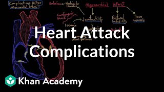 Complications after a heart attack myocardial infarction  NCLEXRN  Khan Academy [upl. by Glassco316]