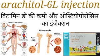 Arachitol 6L injectioncholecalciferol 600000iuvitamin d3 injection ke fayde upyog in hindi [upl. by Warford59]