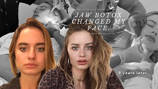 The truth on how I changed my face shape 🎀 ✨JAW BOTOX ✨🎀 [upl. by Vite]