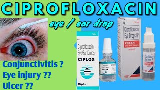 Ciprofloxacin eye drops ear drops  ciplox eye drops Zoxan eye drops [upl. by Adnoved]