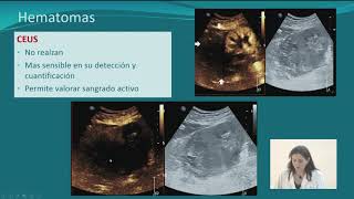 Técnicas diagnósticas Ecodoppler TC biopsia del injerto Renograma isotópico [upl. by Velma291]