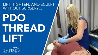 How does a PDO Thread Lift work to lift tighten and sculpt without surgery [upl. by Rees]