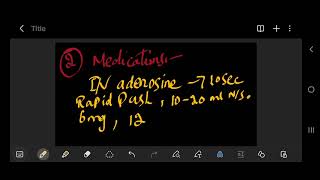 Supraventricular Tachycardia svt [upl. by Loralie]