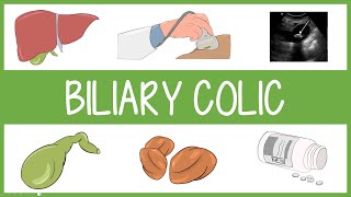 Biliary Colic with mnemonics [upl. by Weksler]