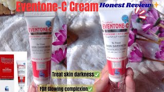 EventoneC Cream  Medicated cream for Skin Whitening 🤩 EventoneC Cream Review✨ [upl. by Ainod]