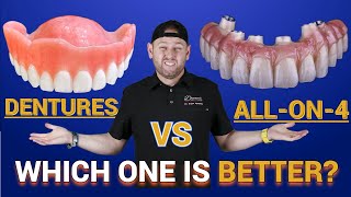 Dentures vs Snap in Dentures vs ALL on 4 ®️ Bridge [upl. by Oileduab]