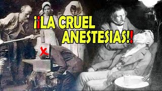 EL MUNDO SIN ANESTESIA │ La despiadada época de los médicos [upl. by Ecerahc]