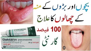 Daktarin oral gel Uses  How To Use Daktarin oral gel  Miconazole  mouth ulcer treatment [upl. by Carberry876]