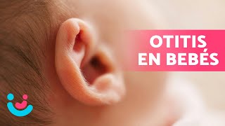 OTITIS en BEBÉS 👶🏻👂🏻  Síntomas Tratamiento y Cómo Prevenirla ✅ [upl. by Caines]