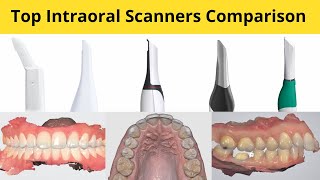 Top Intraoral Scanners Comparison [upl. by Xyno]