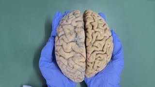 CEREBRUM  EXTERNAL FEATURES  SULCI AND GYRI  NEUROANATOMY Part  2 [upl. by Myrilla752]