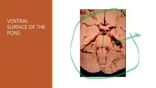 CLINICAL NEUROANATOMY OF PONS INTERACTIVE VIDEO WITH QUIZ [upl. by Annair]