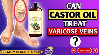 Castor Oils Trending Treatment for Varicose Veins  Castor Oil for Treating Varicose Veins [upl. by Zoubek503]