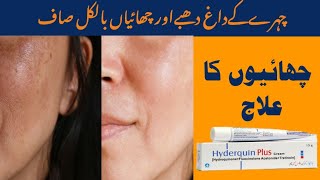 How To Treat Pigmentation  Chehre ki Chaiyon ka Ilaaj [upl. by Siradal423]