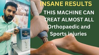 what is shockwave therapy AVN  tendinopathy  ED  What does a shockwave feel like physiotherapy [upl. by Rebmat]