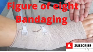 Figure of Eight Bandaging by PC nursing procedure [upl. by Verna]