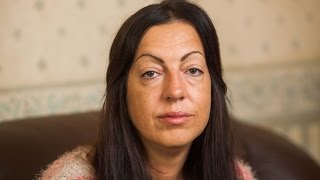 British Woman Had A Stroke And Woke Up With A Permanent Chinese Accent [upl. by Etnahsa]