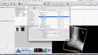 How to import DICOM and JPEGs into OsiriX Lite [upl. by Notnil]