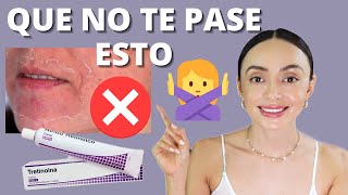 Lo que DEBES saber al INICIAR con TRETINOINA y tener ÉXITO ⭐ Método de 5 fases [upl. by Feirahs]