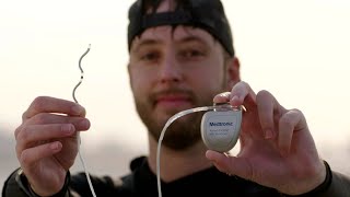 Harrisons story Living with the Medtronic EVICD™ system [upl. by Yllod]