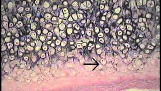 Cartilage and Bone Histology FreeMedEd [upl. by Bidget]