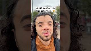 Er wurde OHNE NASE geboren 😨 motivation jannikfreestyle [upl. by Aramad]