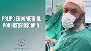 Retirada de Pólipo endometrial por Histeroscopia [upl. by Yerffej583]