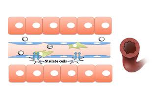 PORTAL HYPERTENSION EXPLAINED Hepatic portal vein hypertension explained [upl. by Nonnahs]