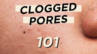 🤭Everything you need to know about CLOGGED PORES • Skincare amp makeup products are not the culprit [upl. by Hildagard]