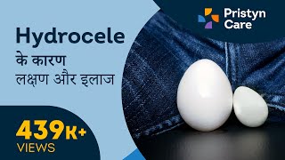 Hydrocele के कारण लक्षण और इलाज  Testicle swelling  For FREE Consultation Call On 6366528295 [upl. by Survance]