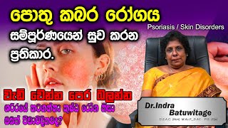 පොතු කබර රෝගය සුවකරමු  Psoriasis  Pothu Kabara Sinhala  Skin Disorder  Dr Indra Batuwitage [upl. by Lorri923]