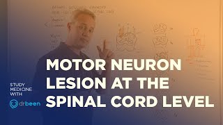 Motor Neuron Lesions at the Spinal Cord Level  Upper And Lower Motor Neuron Deficit [upl. by Froehlich500]