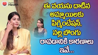 Pigmentation  ఈ వయసు దాటిన అమ్మాయిలకు నల్ల బొంగు రావడానికి కారణాలు Dr Suvidha Gandra  ToneHealth [upl. by Aihsoem]