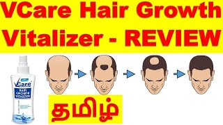 VCare Hair Growth Vitalizer review   MUST WATCH [upl. by Avot]