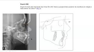 Aula de Cefalometria [upl. by Antonetta]