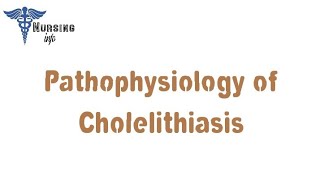 Pathophysiology of Cholelithiasis [upl. by Raveaux]