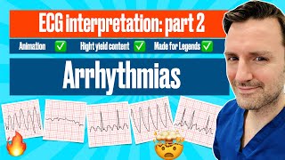 Arrhythmias A Visual Guide with ECG Criteria ecgmadeeasy [upl. by Tnecnivleahcim]