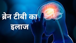 BRAIN TB  TB Meningitis  Tuberculoma  ब्रेन टीबी [upl. by Ytsirhc]