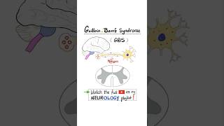 GuillainBarré Syndrome GBS  Part 2…anatomy biology science neuroscience nurse doctor [upl. by Yerffej478]