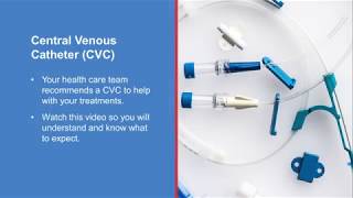 Central Venous Catheter CVC Demonstration  anesthesiology anesthesia anaesthesia cvc [upl. by Sondra]