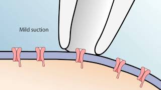 Sewing Patches on Elbows [upl. by Ehcnalb]