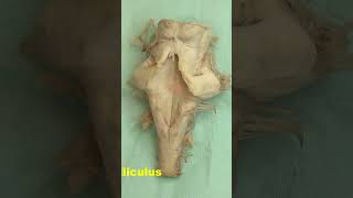 Facial colliculus Rhomboid fossa neuroanatomy brain brainstemrhomboidfossa [upl. by Asselem]