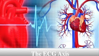 ECG Axis Tutorial Part 2  Hexaxial Reference System [upl. by Dercy]