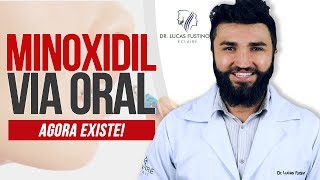 MINOXIDIL ORAL Tomar Minoxidil é melhor do que passar   Dr Lucas Fustinoni [upl. by Natlus562]