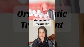 Orthodontic treatment orthodontics orthodontic dentist dentista doctor [upl. by Otrebliw]