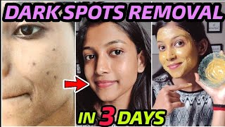 Remove DARK SPOTS NATURALLY in 3 Days 😍 Hyperpigmentation Acne Scars Brown Spots [upl. by Kyd407]