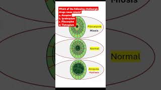 Which of the following cholinergic drugs cause miosis [upl. by Sadirah]