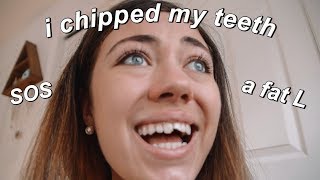 hi i chipped my teeth COLLEGE STORY TIME [upl. by Leor831]